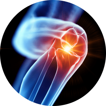 Knee pain graphic