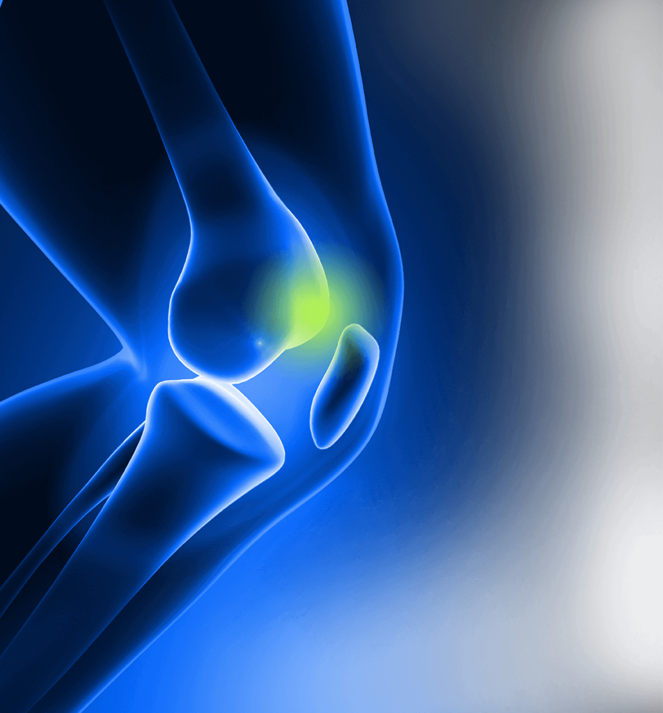 Knee surgery graphic