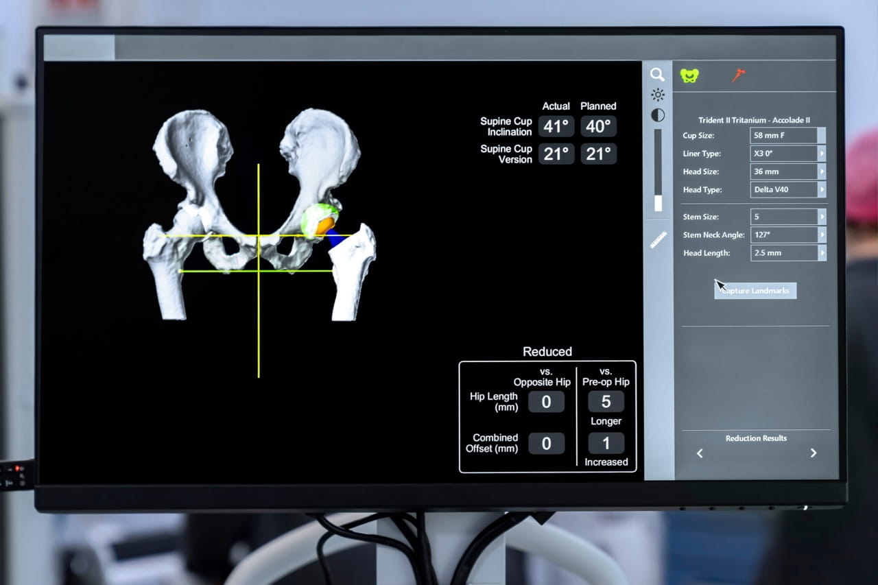 Surgical robotic system interface