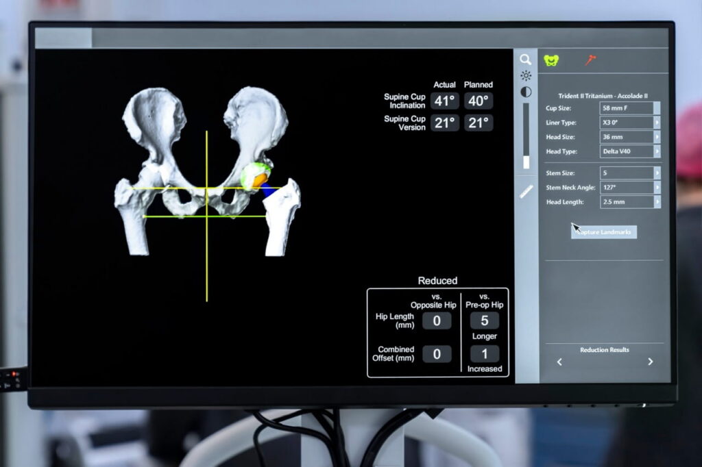 Robotic surgery platform interface